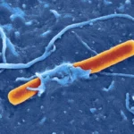 Sexually Transmitted Shigella Infections Rise As Drug Resistance Grows